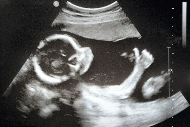 Bildschirmarbeiter - Picdump 28.05.2010