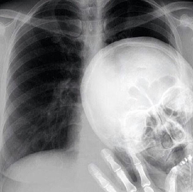 Bildschirmarbeiter - Picdump 20.02.2015