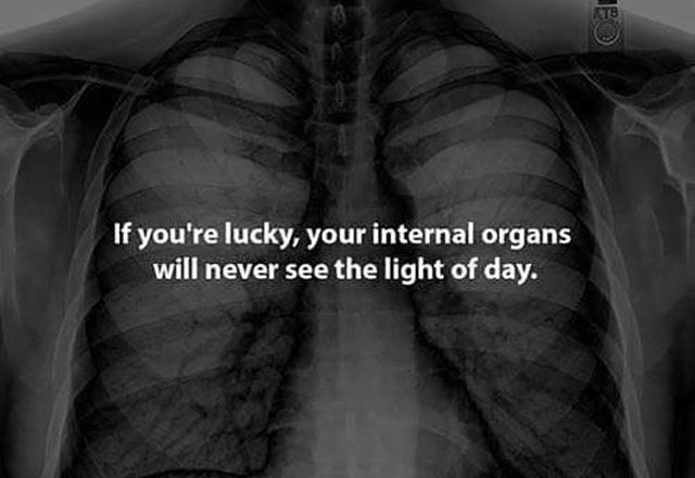 Bildschirmarbeiter - Picdump 15.05.2015