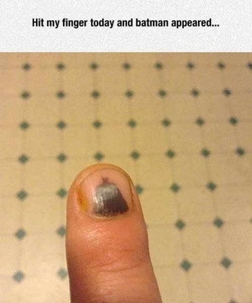 Bildschirmarbeiter - Picdump 22.01.2016