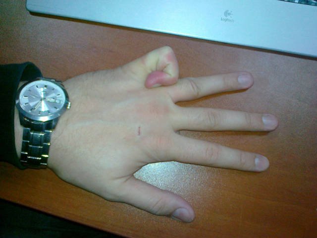 Bildschirmarbeiter - Picdump 15.07.2016