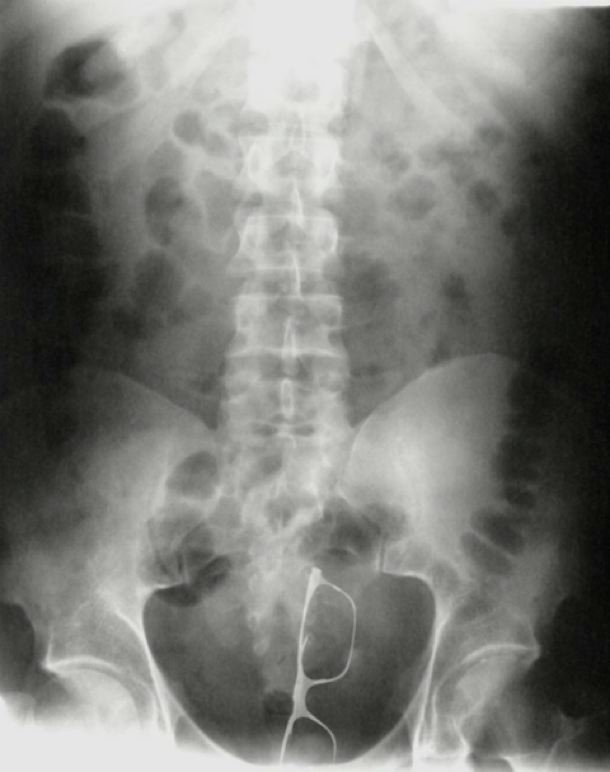 Bildschirmarbeiter - Picdump 11.11.2016