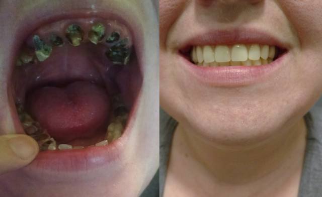 Bildschirmarbeiter - Picdump 20.01.2017 - NACHSCHLAG